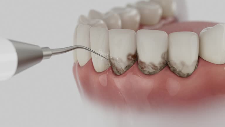 Reliable Dental Implants contractor in Walnut, IL by Smile Center Dentistry